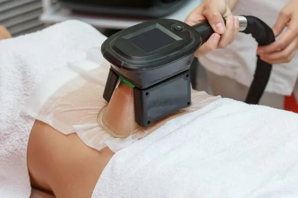Image of person having fat freezing treatment to help weight gain Ravenscliffe