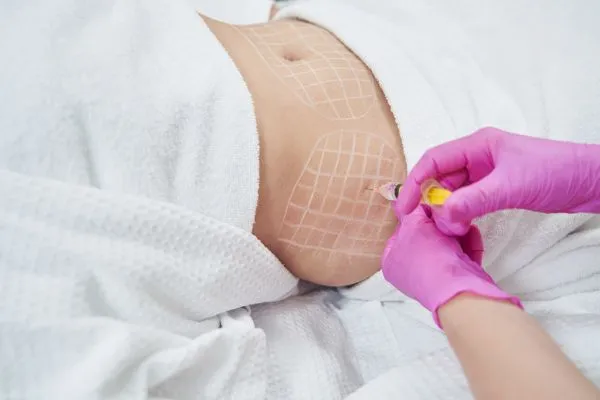 image of fat dissolving injections on love handles to help combat weight gain Ravenscliffe