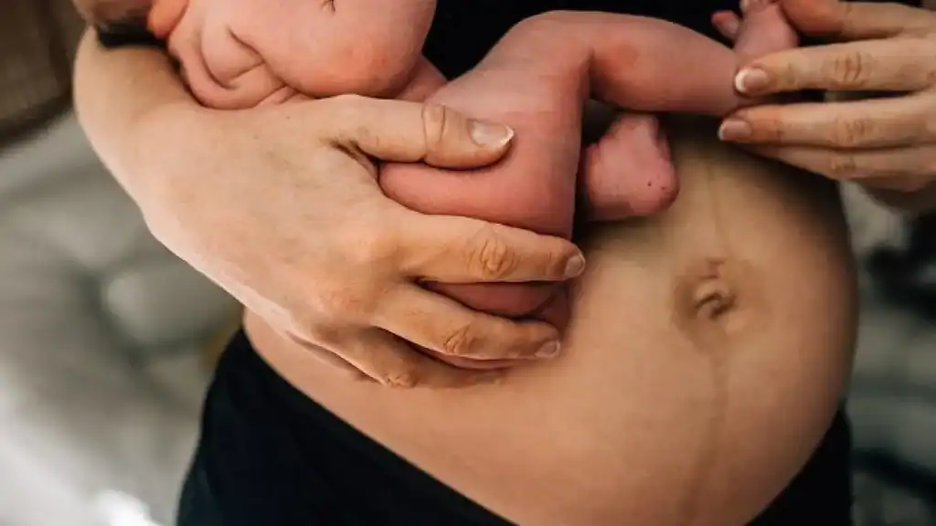 Why Is My Stomach Still Big After Pregnancy Ravenscliffe?